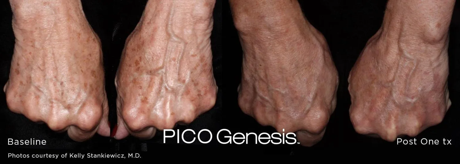 PICO Genesis in Las Vegas at Original You