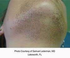 Before Treatment at Original You in Las Vegas