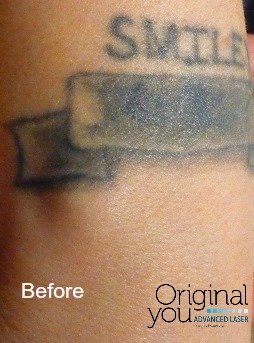 before and after